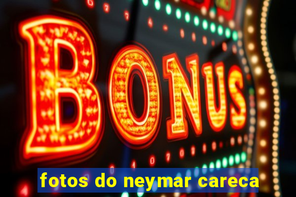 fotos do neymar careca